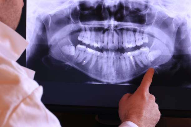 Best Chipped Tooth Repair Near Me  in Onarga, IL